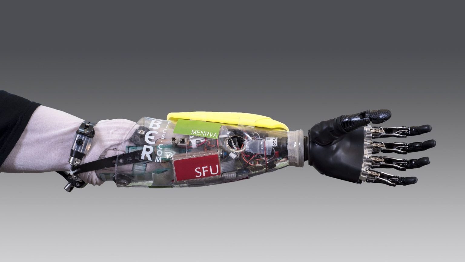 A robotic prosthetic arm with visible internal mechanisms, wires, and a mechanical hand. Labels such as "SFU" and "BESOM" are visible on the arm casing.