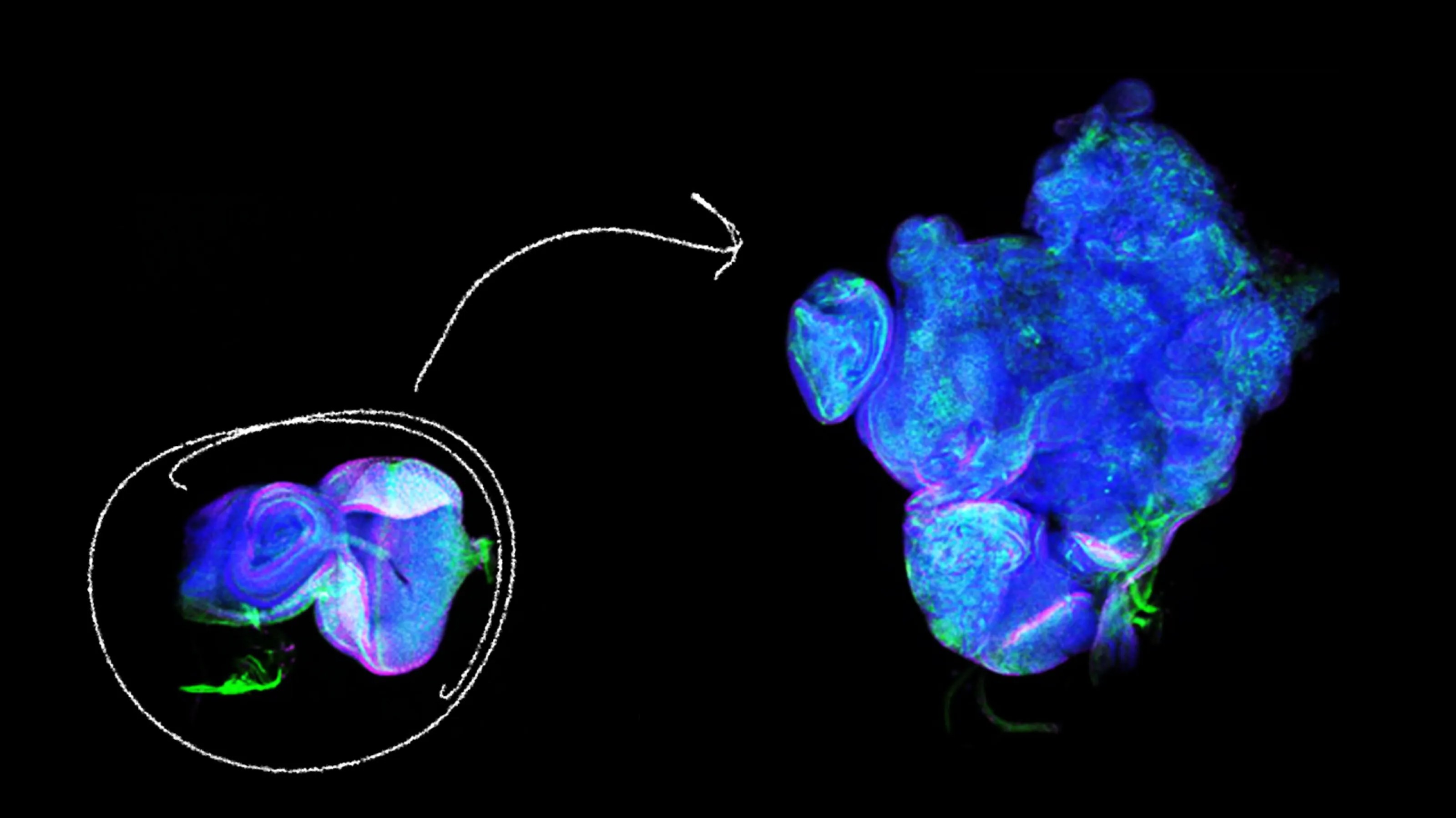 Fluorescence microscopy image showing a close-up of cells in vibrant blue and green colors, with an arrow indicating a magnified section.